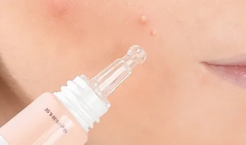 Ujung aplikator Acne Spot Treatment menyentuh jerawat di pipi