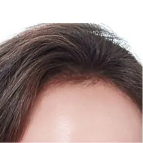 Garis rambut dan akar rambut hitam di dahi